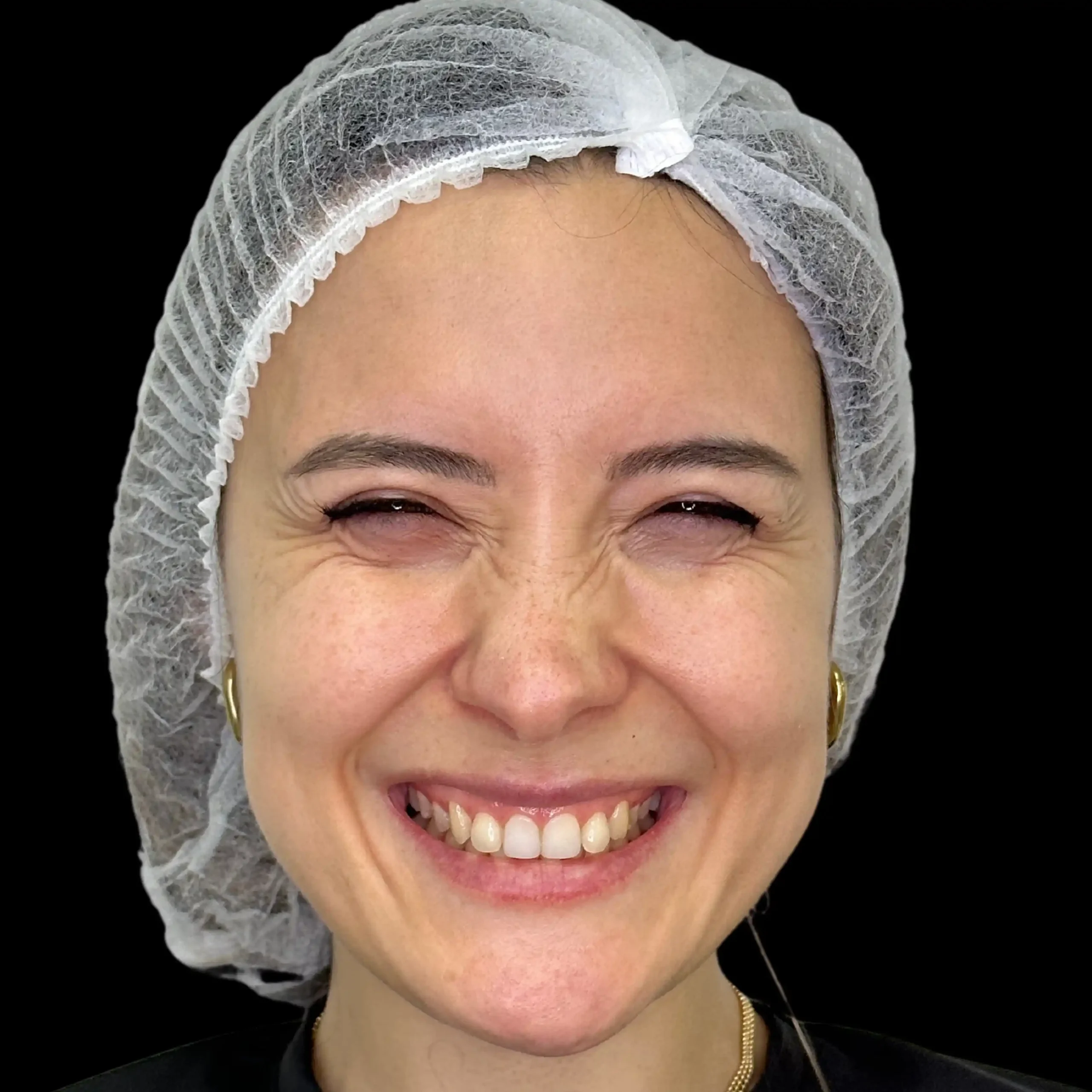 Antes Sonrisa