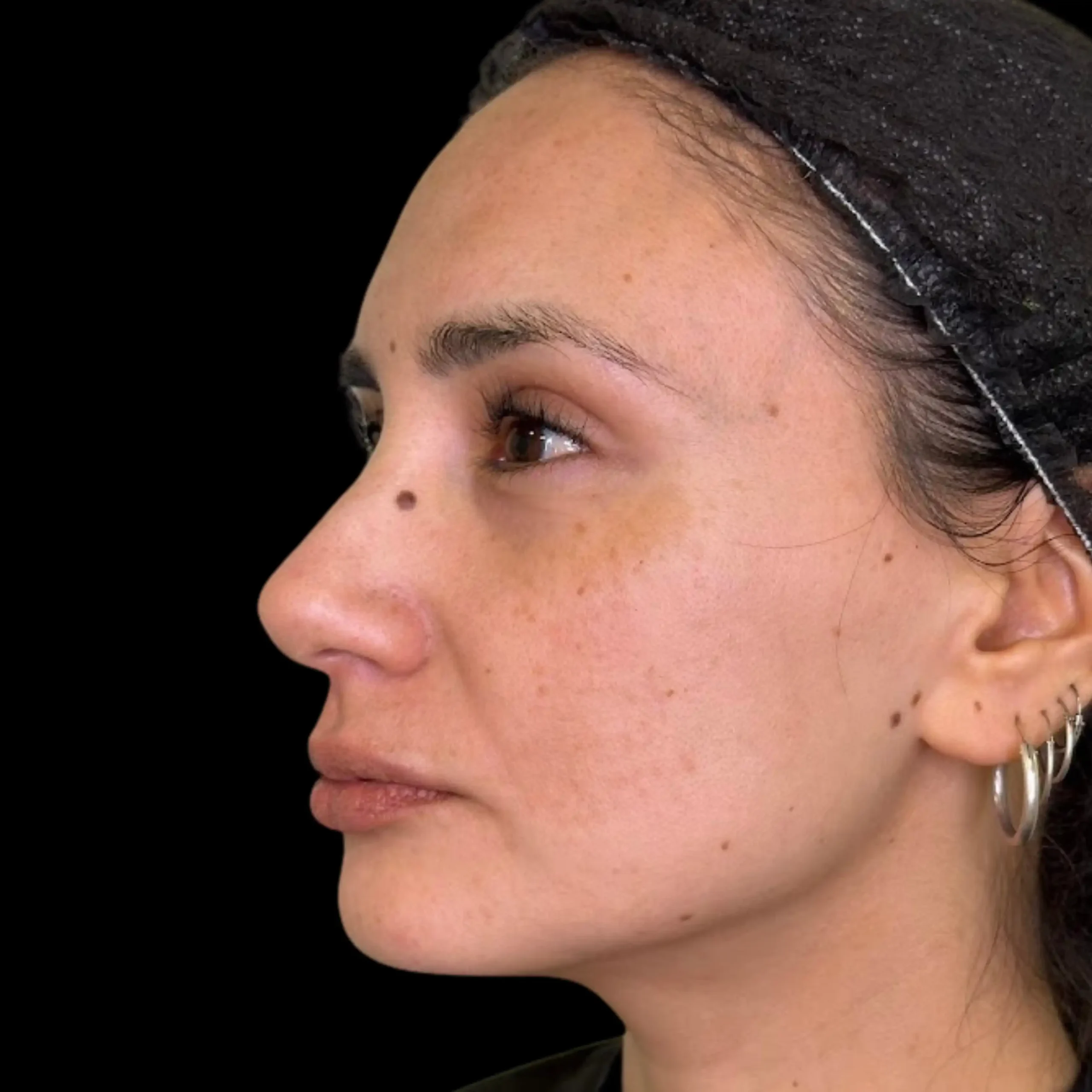 Después Perfil 2