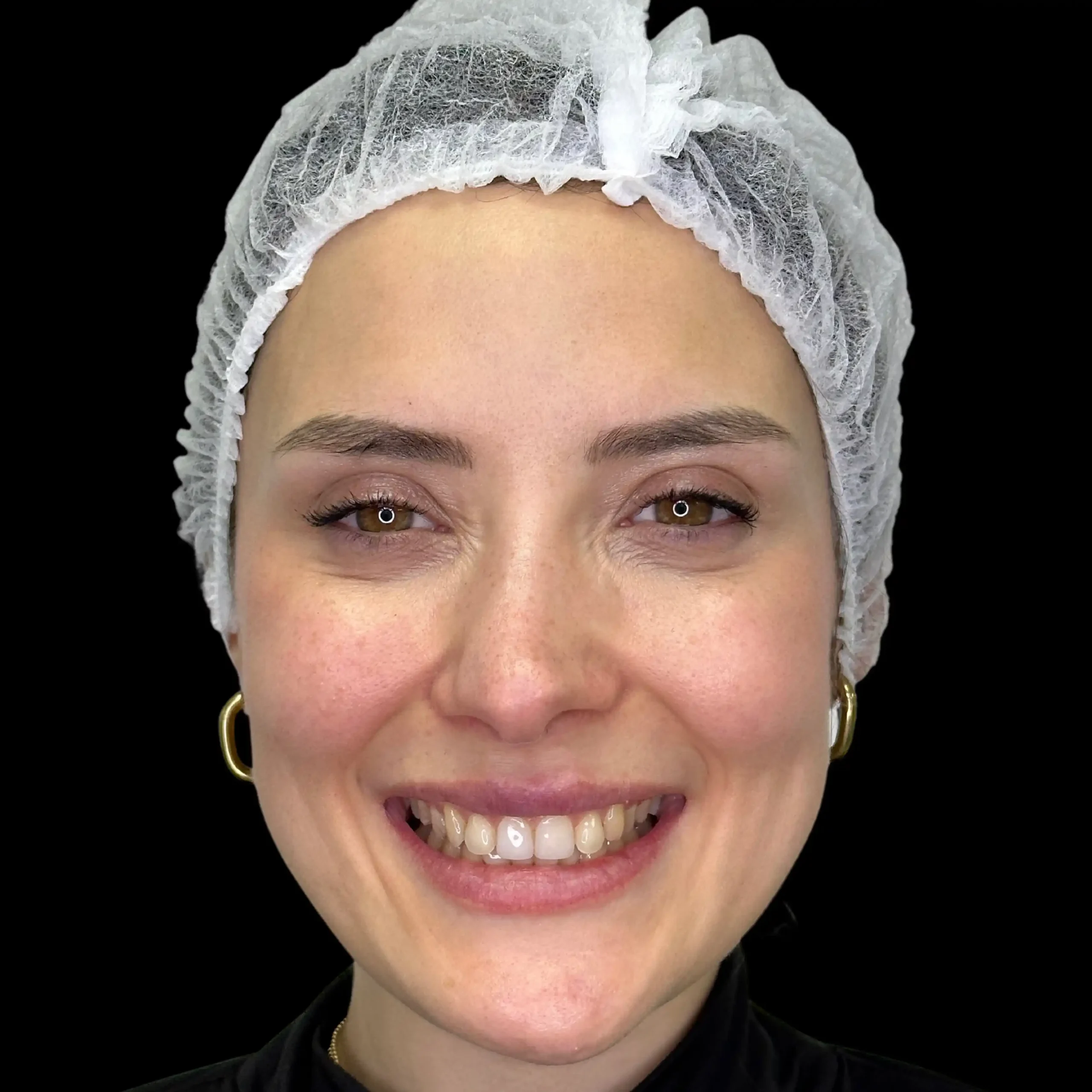 Después Sonrisa