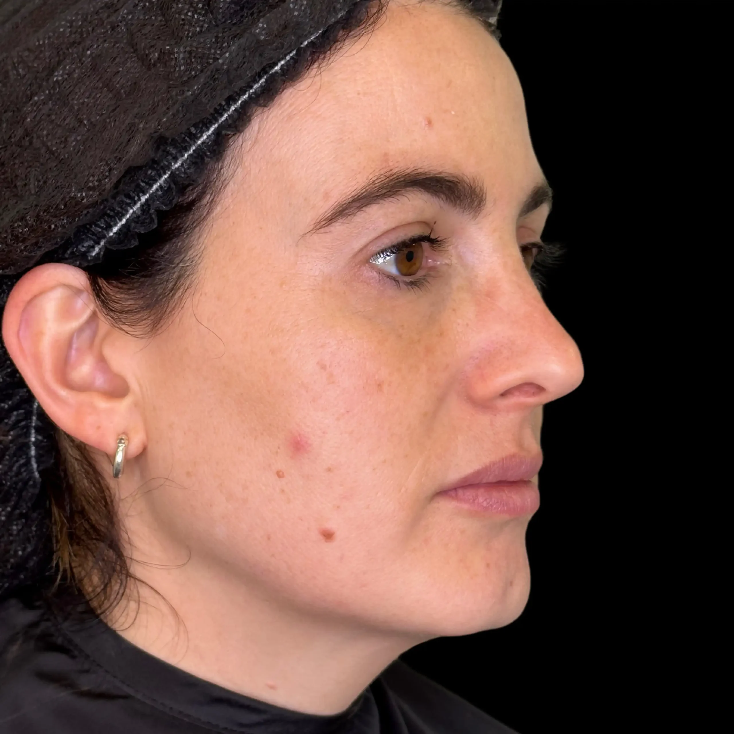 Despues Perfil