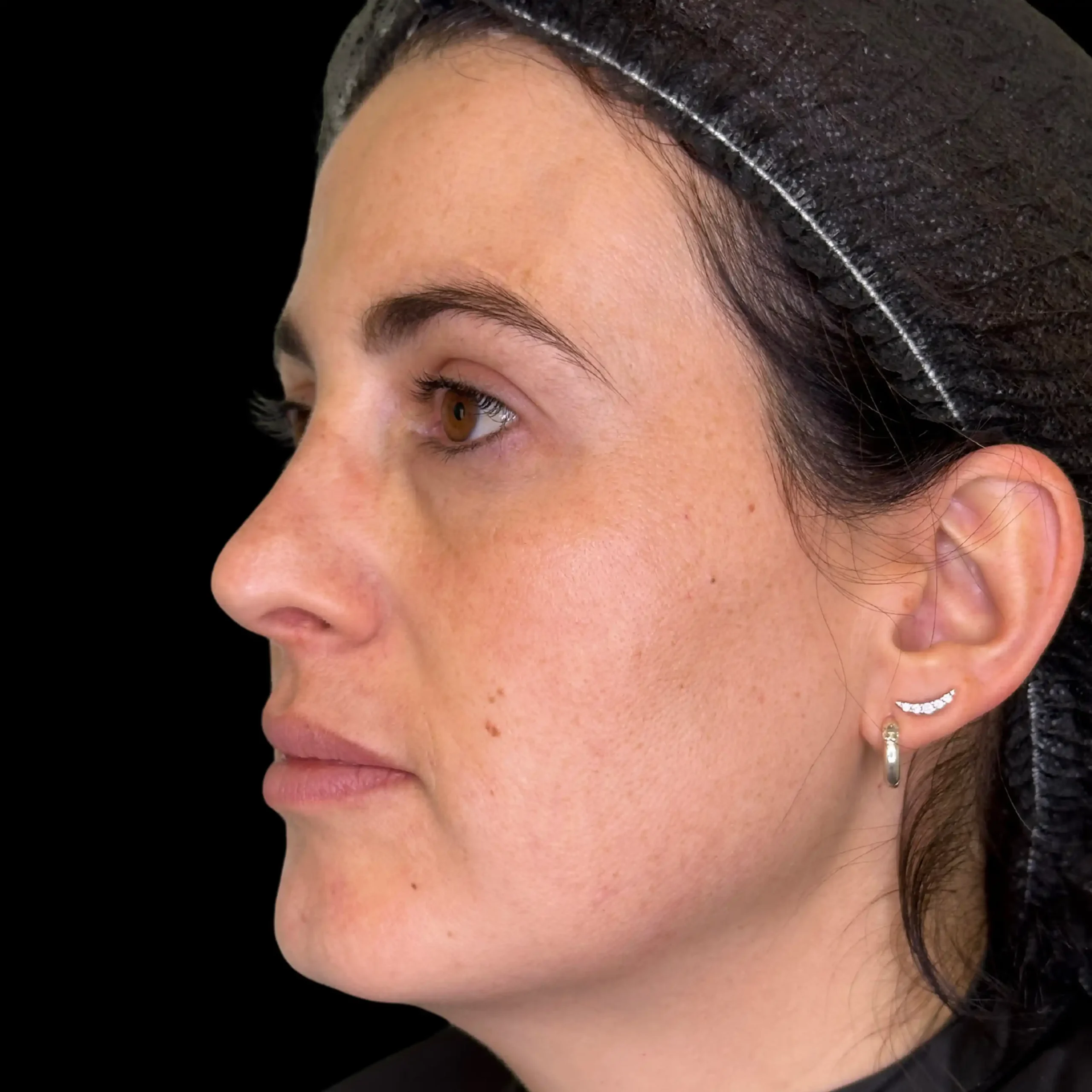 Despues Perfil 2